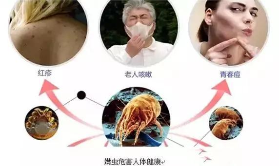 「健康」涼席放了一整年養(yǎng)肥了螨蟲(chóng)？2個(gè)小工具，2分鐘徹底清除