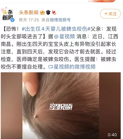 家中的小孩被蜱蟲咬了怎么辦？如何對付蜱蟲？